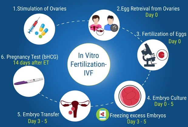 IVF